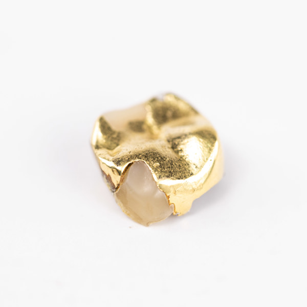 Tandguld, orensat, vikt 2,1 gram